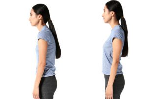 Can a Chiropractor Help With Bad Posture - Can a Chiropractor Help With Bad Posture?