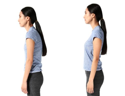 Can a Chiropractor Help With Bad Posture?